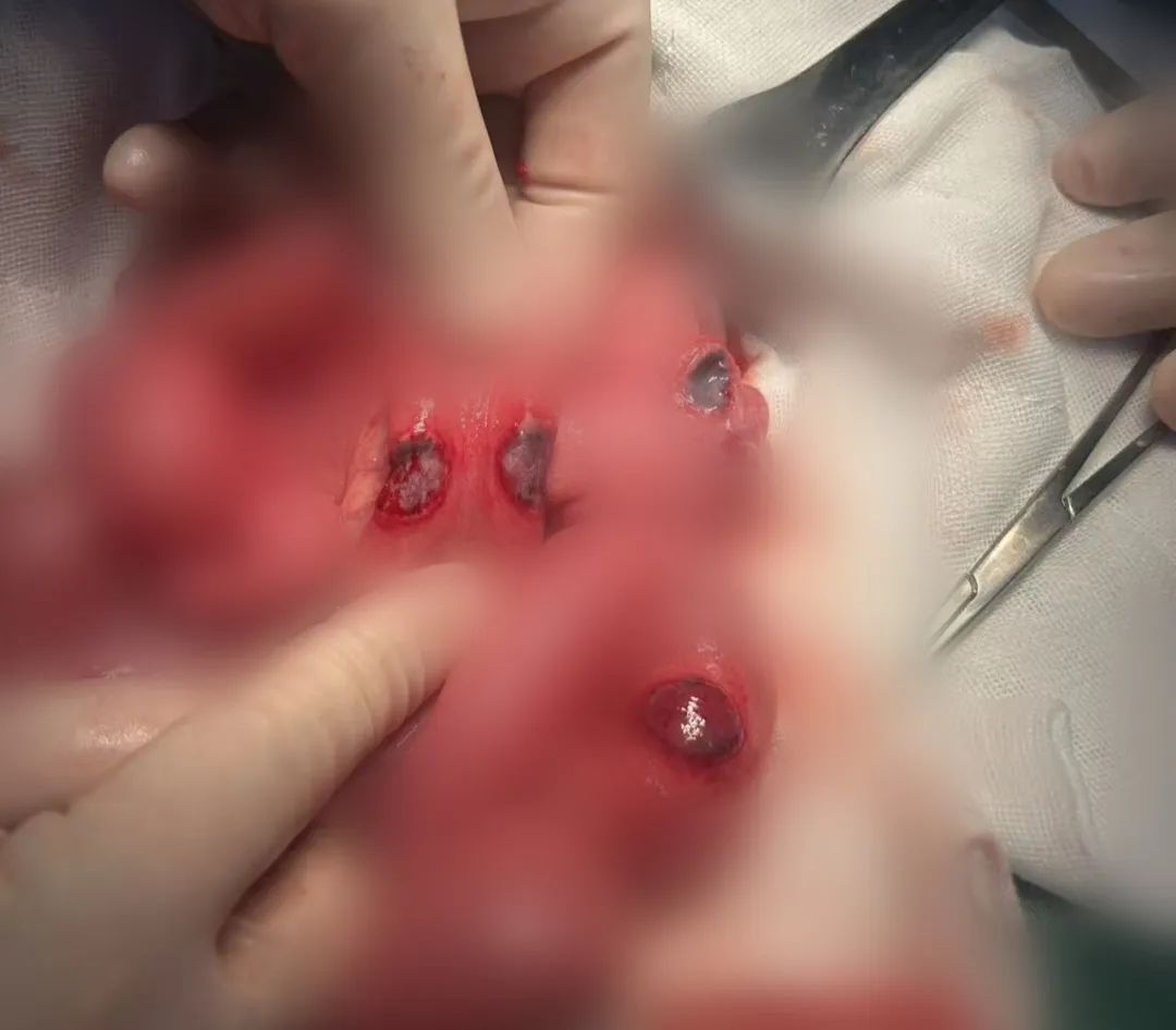 近期频发!重庆一医院接诊近20例,医生提醒:这些小物件或引发大隐患 近期频发!重庆一医院接诊近20例,医生提醒:这些小物件或引发大隐患