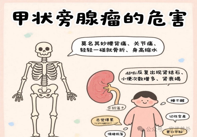 悄悄扰乱钙平衡的隐形杀手:带你认识甲状旁腺瘤 悄悄扰乱钙平衡的隐形杀手:带你认识甲状旁腺瘤