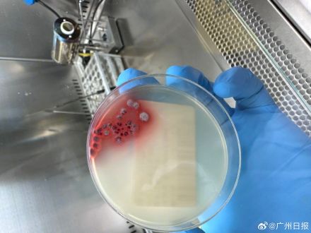 夫妻吃了来偷柑橘的竹鼠后双双肺炎 夫妻吃了来偷柑橘的竹鼠后双双肺炎