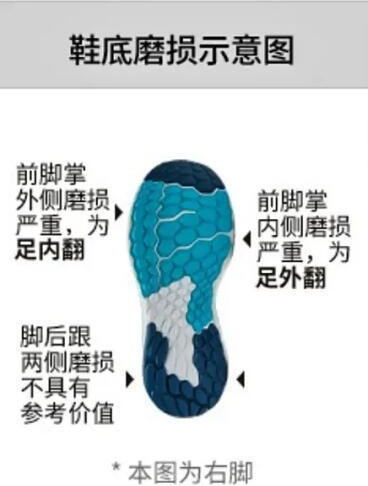 走路跑步总累？可能是脚的这个地方出了问题