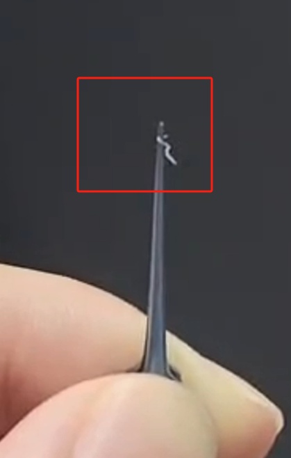 不要拍!有人已中招,眼内取出4条蠕动的寄生虫 不要拍!有人已中招,眼内取出4条蠕动的寄生虫