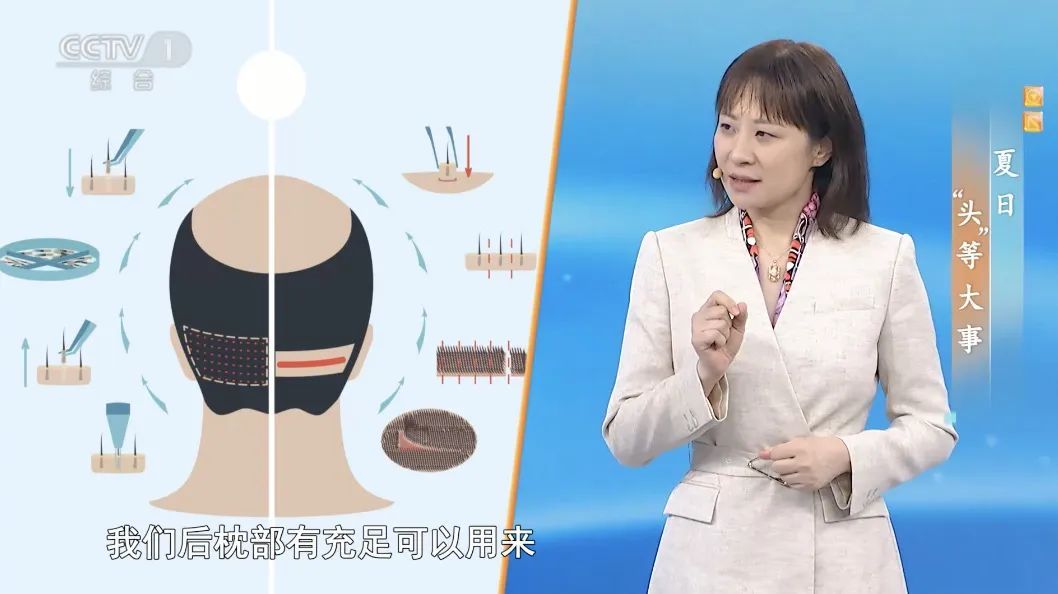 这些美发方式可能会致癌！夏天头发出油多、爱掉发？做好这4件事，帮你拥有一头秀发