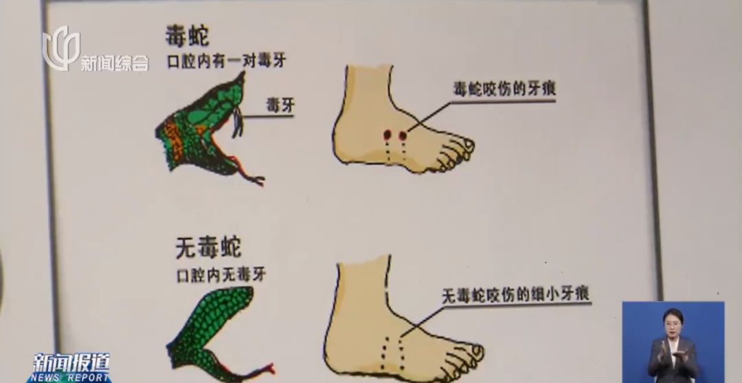 上海七旬老人小区散步被毒蛇咬伤,女儿崩溃:医院怎么选……这份救命指南快收好! 上海七旬老人小区散步被毒蛇咬伤,女儿崩溃:医院怎么选……这份救命指南快收好!