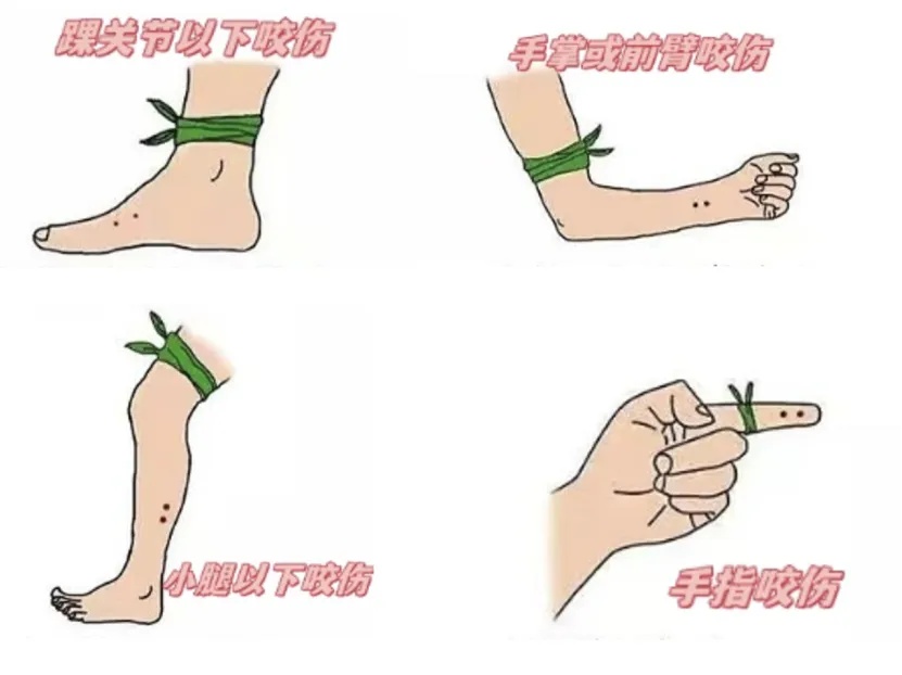 上海七旬老人小区散步被毒蛇咬伤,女儿崩溃:医院怎么选……这份救命指南快收好! 上海七旬老人小区散步被毒蛇咬伤,女儿崩溃:医院怎么选……这份救命指南快收好!