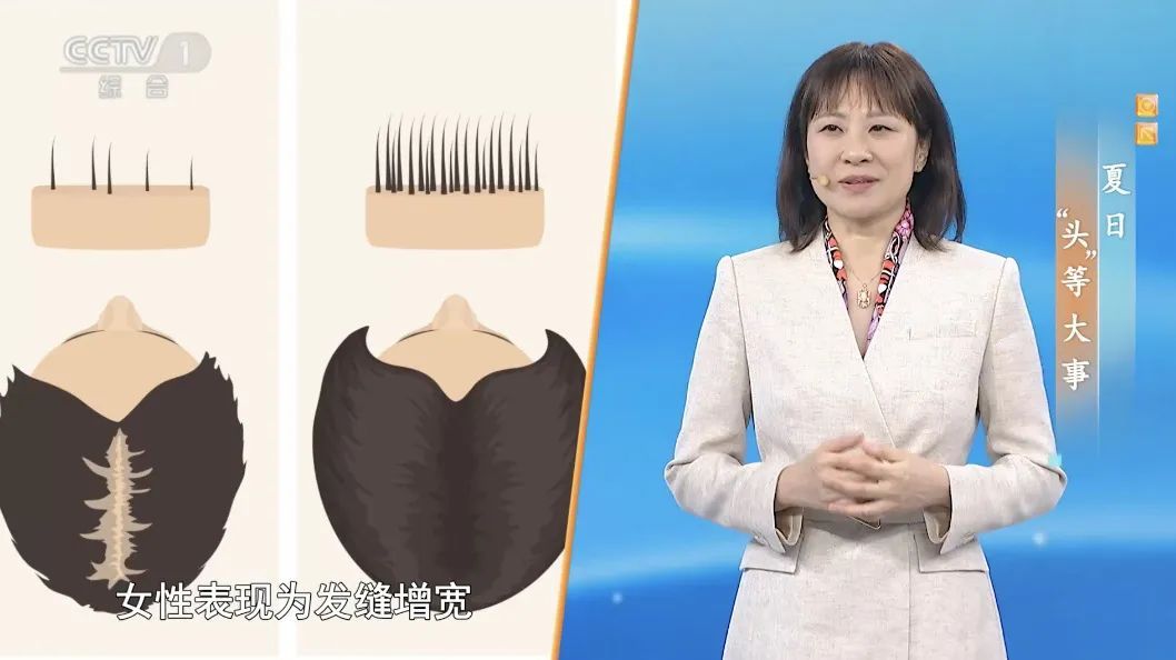 这些美发方式可能会致癌！夏天头发出油多、爱掉发？做好这4件事，帮你拥有一头秀发