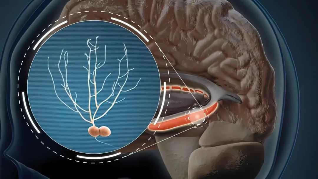 找到了!我国科学家发现大脑里藏着一只“GPS”专门给手导航 找到了!我国科学家发现大脑里藏着一只“GPS”专门给手导航
