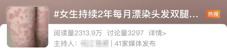 一女生每月漂染头发,全身长满紫斑!这些美发方式可能会致癌,紧急提醒! 一女生每月漂染头发,全身长满紫斑!这些美发方式可能会致癌,紧急提醒!