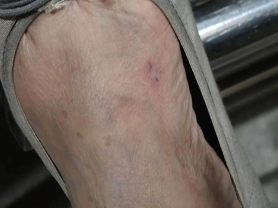 上海75岁老人小区内被毒蛇咬伤！沪上血清储备医院为何较少？毒蛇来源初判→