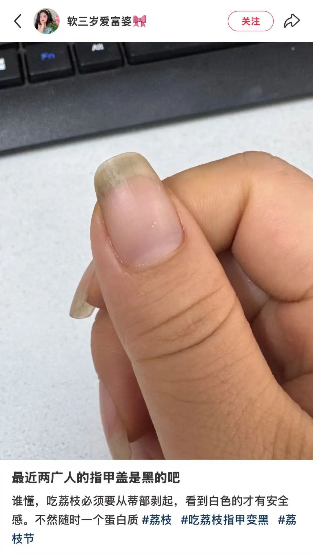 最近，深圳人的大拇指都是黑的