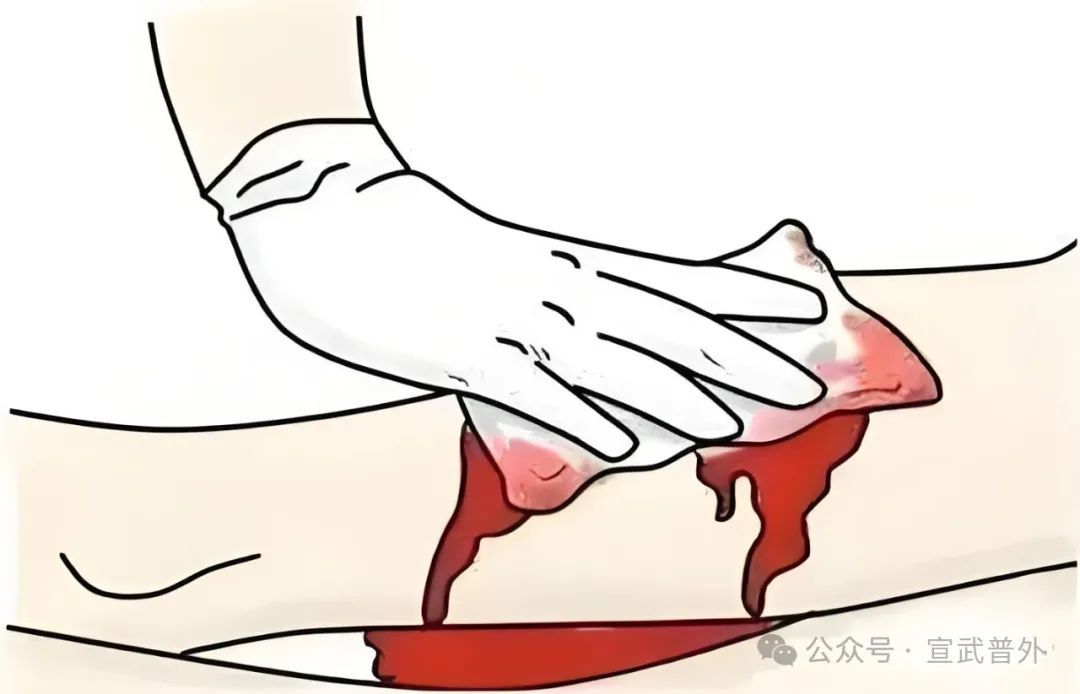 遇到意外伤害,该如何实施救援 遇到意外伤害,该如何实施救援