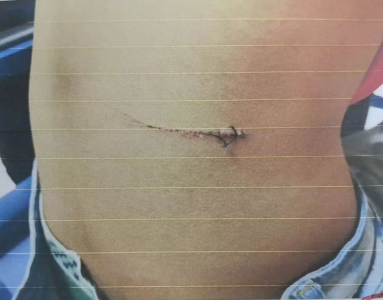 被同事“做局”!女子 “私了 ”2万余元后幡然醒悟 被同事“做局”!女子 “私了 ”2万余元后幡然醒悟