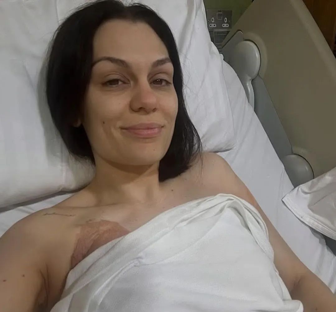 知名歌手“结石姐”分享乳腺癌术后照片：病容憔悴身上缠着绷带，已回家休养等待结果