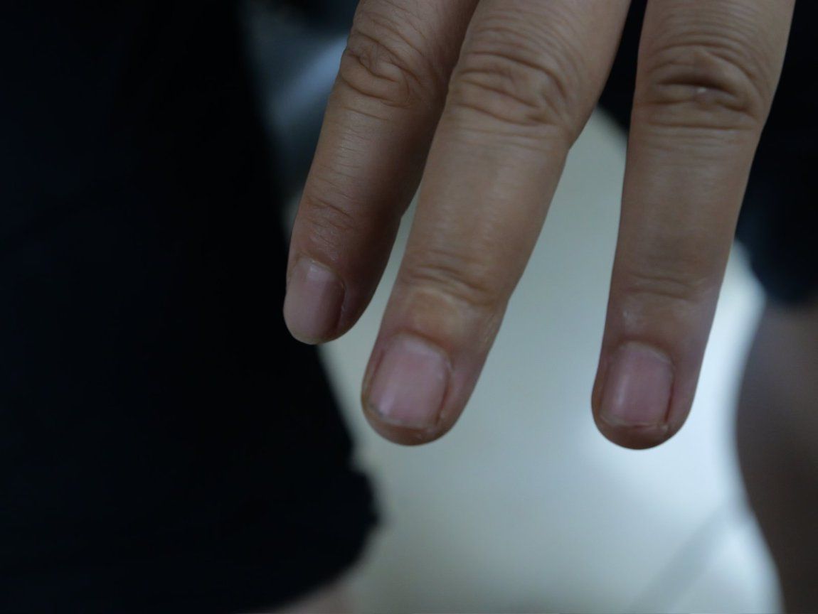 一等功女站长露脸缉毒 10余处伤疤记录生死瞬间 一等功女站长露脸缉毒 10余处伤疤记录生死瞬间