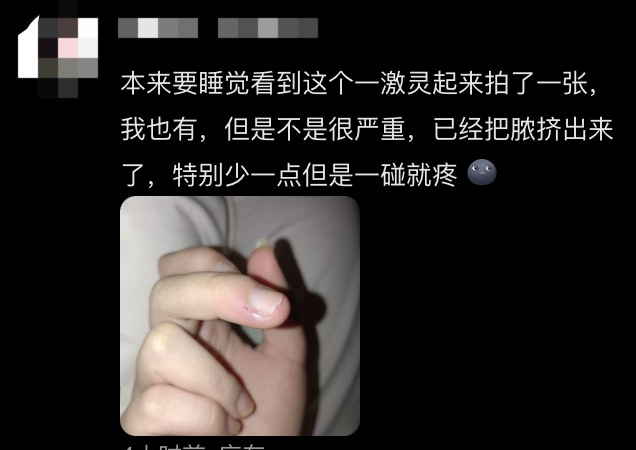 不要拔!不要拔!这习惯的严重后果真会要了命…… 不要拔!不要拔!这习惯的严重后果真会要了命……