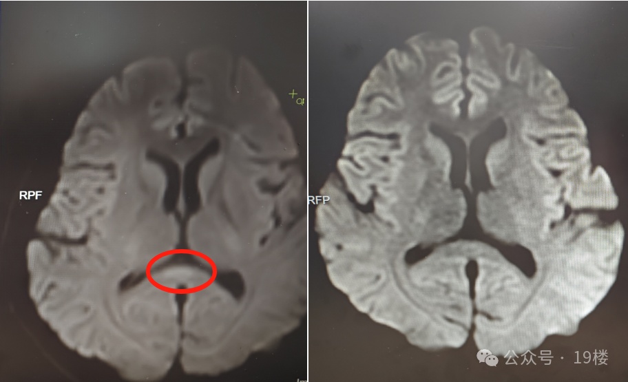 30岁女子突然性情大变,非要在屋里撑红伞!家人崩溃…… 30岁女子突然性情大变,非要在屋里撑红伞!家人崩溃……
