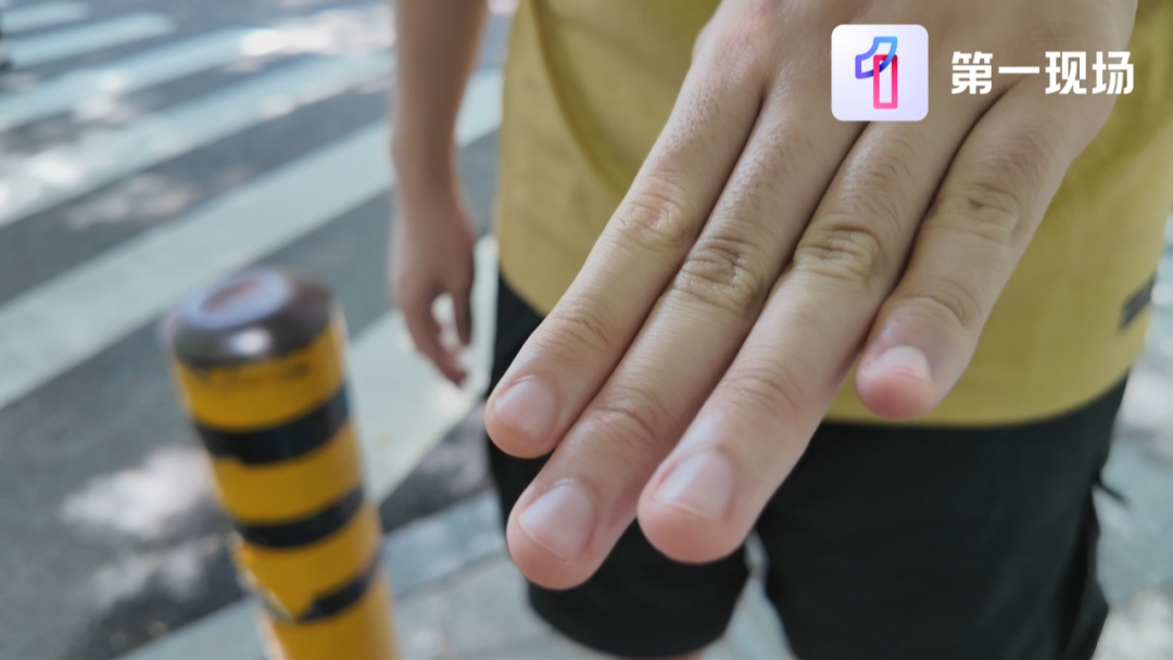 不要拔!不要拔!这习惯的严重后果真会要了命…… 不要拔!不要拔!这习惯的严重后果真会要了命……