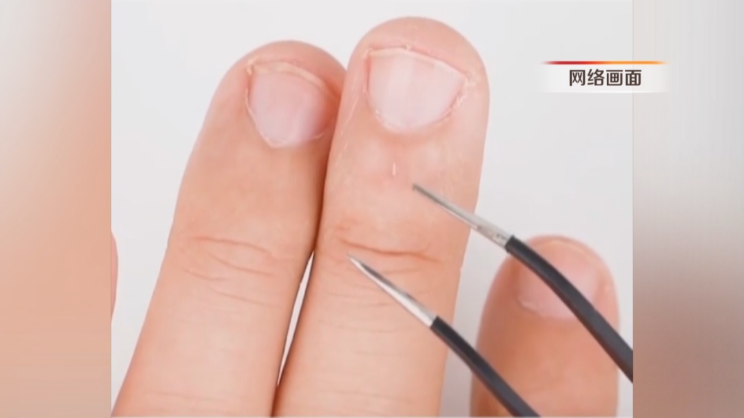 不要拔!不要拔!这习惯的严重后果真会要了命…… 不要拔!不要拔!这习惯的严重后果真会要了命……