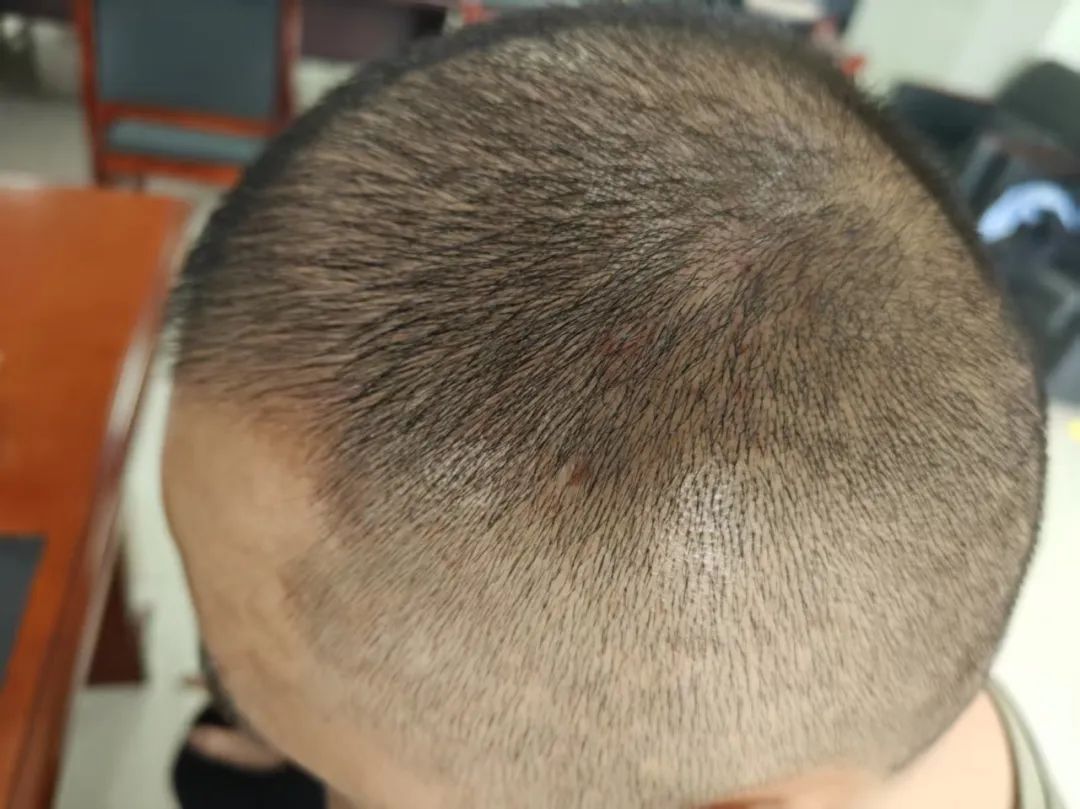 惊心动魄!禁毒民警围捕毒贩,被撞飞20米远 惊心动魄!禁毒民警围捕毒贩,被撞飞20米远