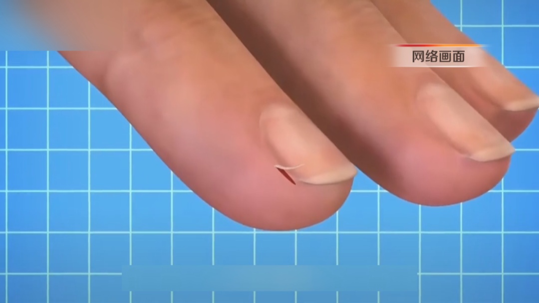 不要拔!不要拔!这习惯的严重后果真会要了命…… 不要拔!不要拔!这习惯的严重后果真会要了命……