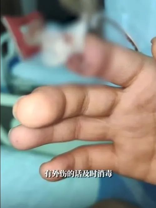 不要拔!不要拔!这习惯的严重后果真会要了命…… 不要拔!不要拔!这习惯的严重后果真会要了命……