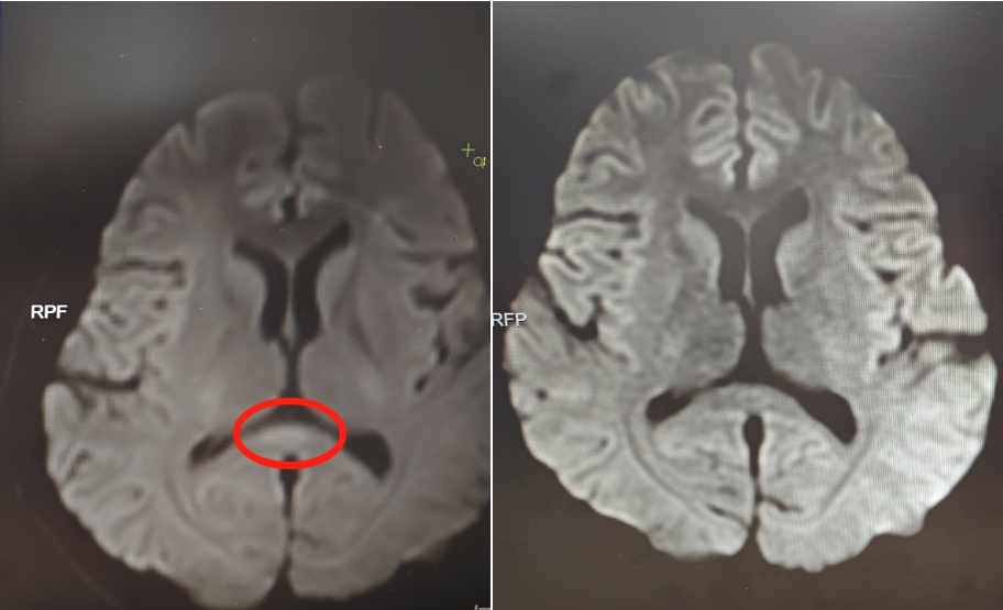 30岁女子突然性情大变,非要在屋里撑红伞!家人崩溃,没想到… 30岁女子突然性情大变,非要在屋里撑红伞!家人崩溃,没想到…