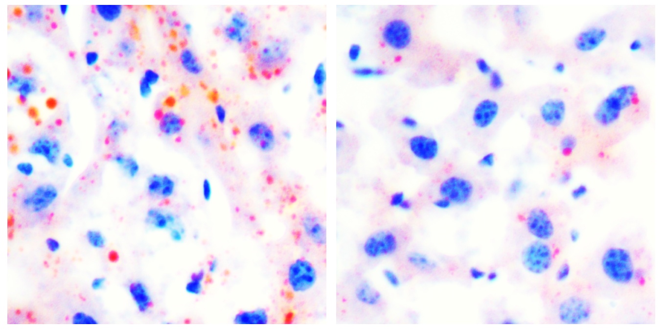 长期规律运动可延缓衰老!我国科学家揭示其中的分子机制 长期规律运动可延缓衰老!我国科学家揭示其中的分子机制