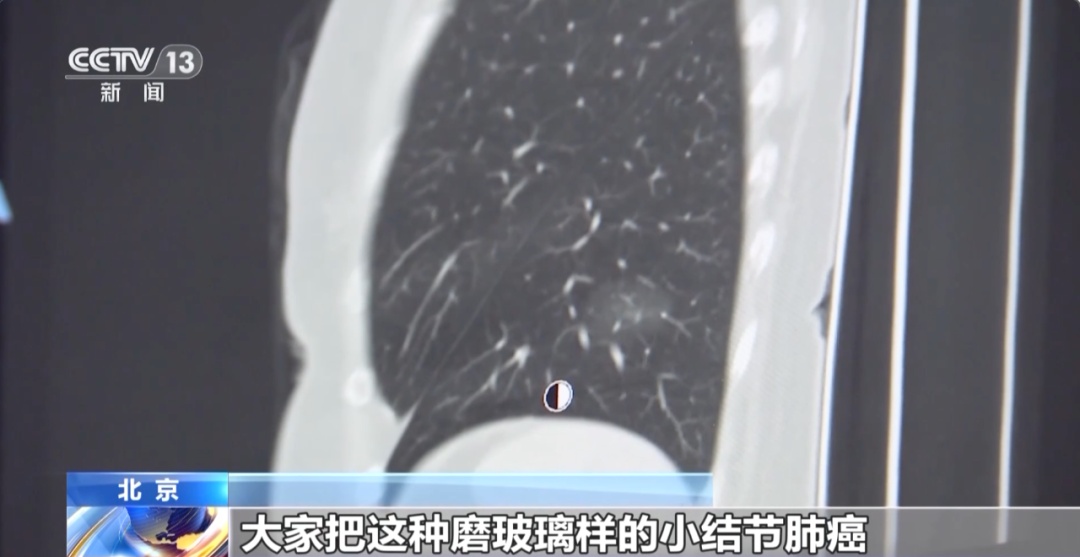 连续10年,全球死亡率第一!这种癌症早期通常无症状→ 连续10年,全球死亡率第一!这种癌症早期通常无症状→