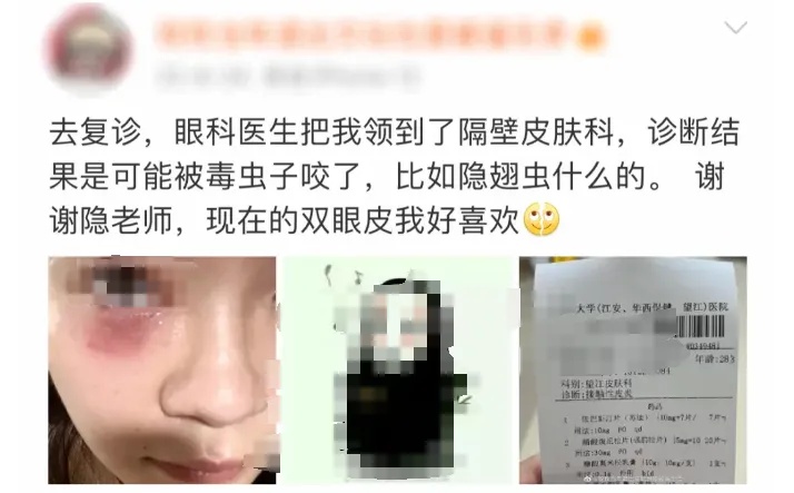 毒液堪比硫酸!女子摸了下脖子就“中招”!千万别碰,有人差点毁容 毒液堪比硫酸!女子摸了下脖子就“中招”!千万别碰,有人差点毁容