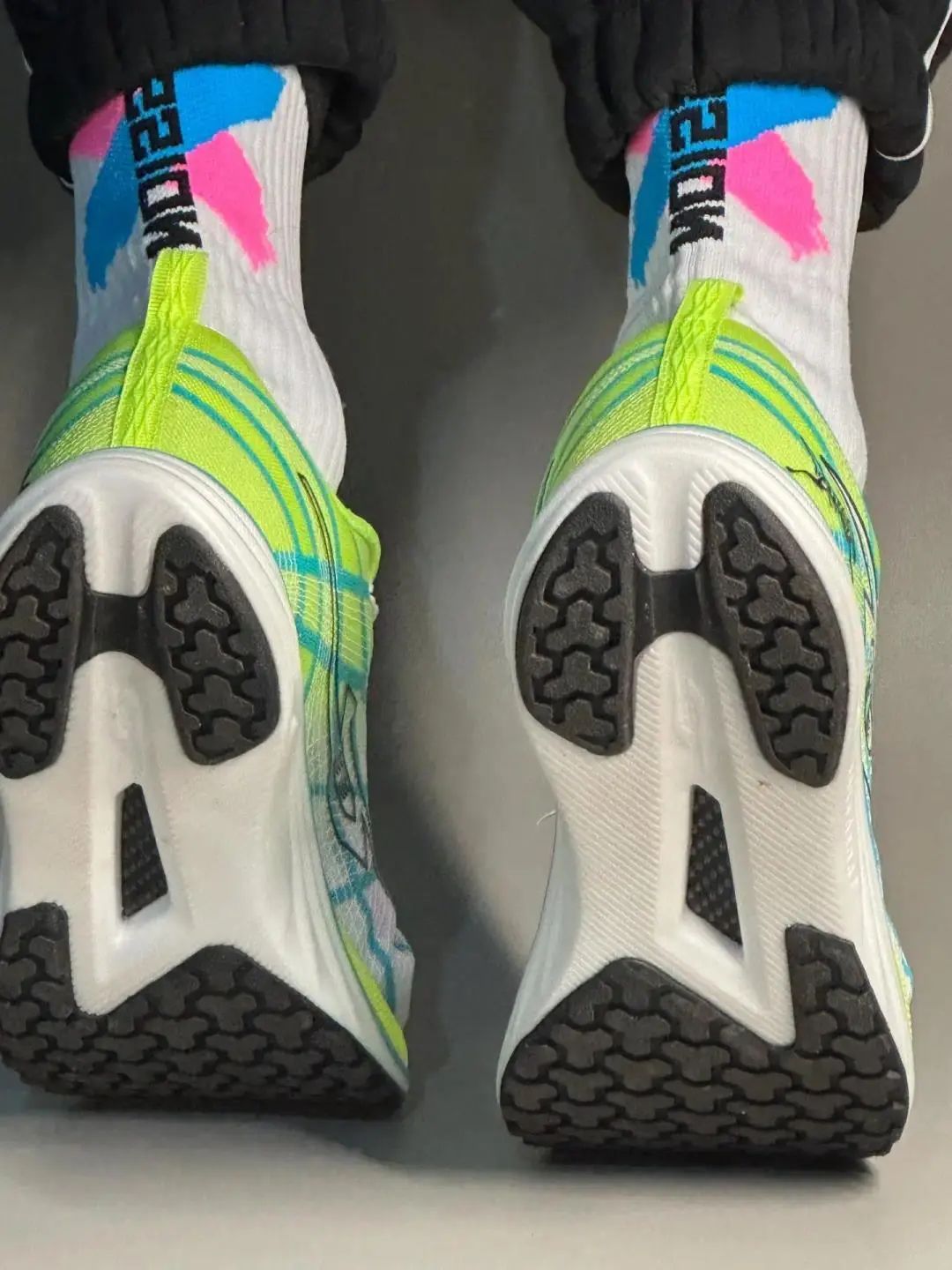 小心!别让孩子长期穿这种鞋 小心!别让孩子长期穿这种鞋