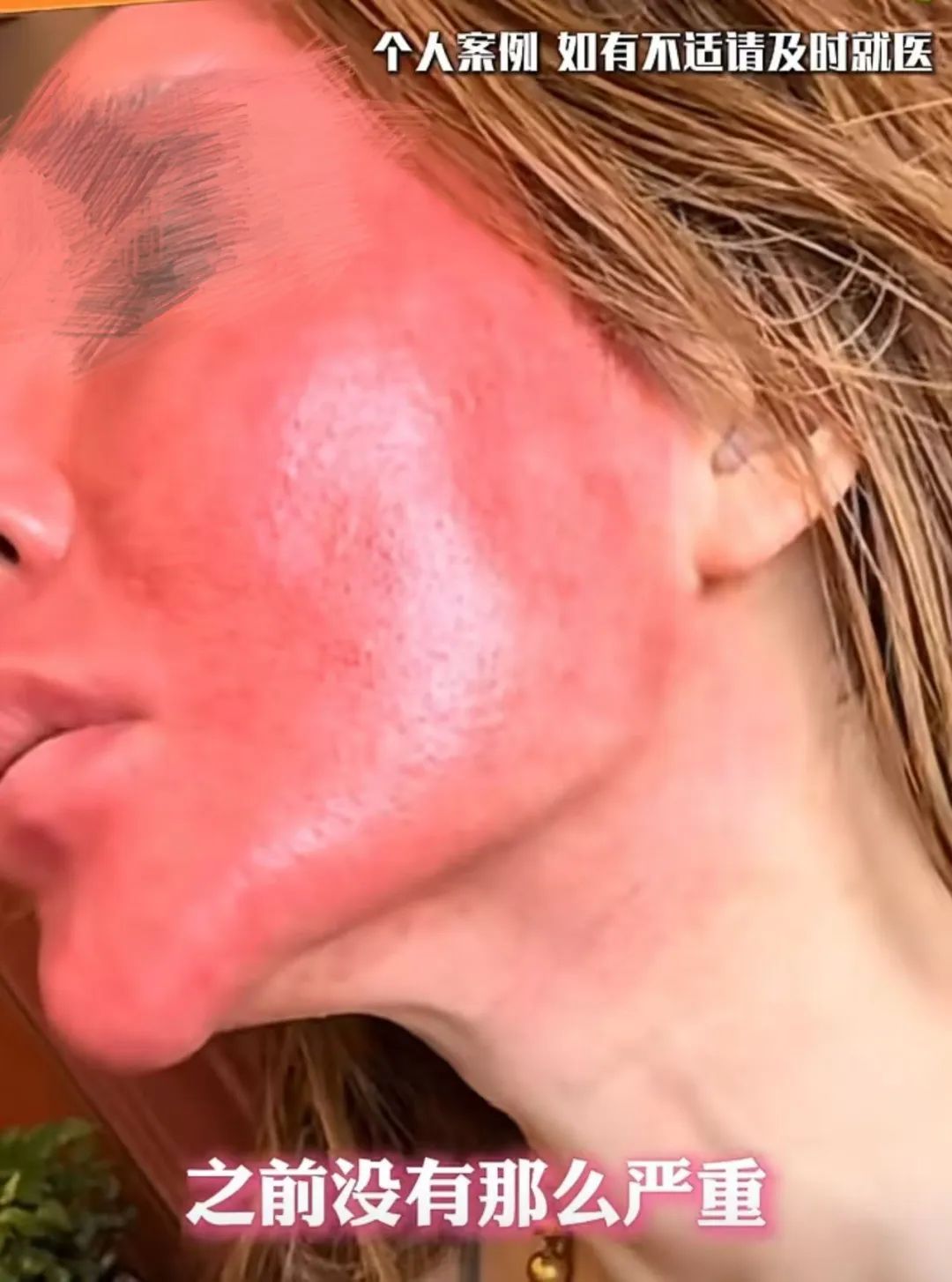 太吓人!女子化妆20年没有卸妆,脸竟然变这样!网友:她怎么能忍住 太吓人!女子化妆20年没有卸妆,脸竟然变这样!网友:她怎么能忍住