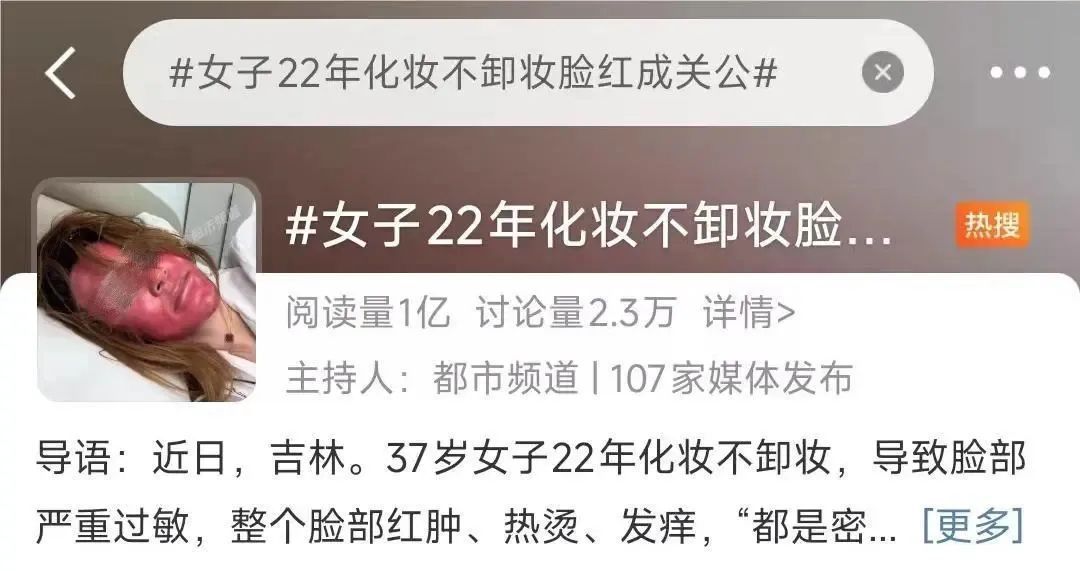 太吓人!女子化妆20年没有卸妆,脸竟然变这样!网友:她怎么能忍住 太吓人!女子化妆20年没有卸妆,脸竟然变这样!网友:她怎么能忍住