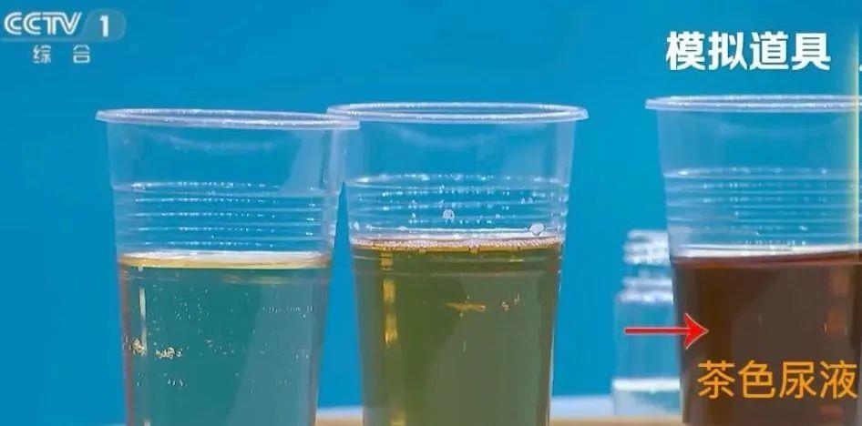 喝水后的5个异常 有1个就需警惕 喝水后的5个异常 有1个就需警惕