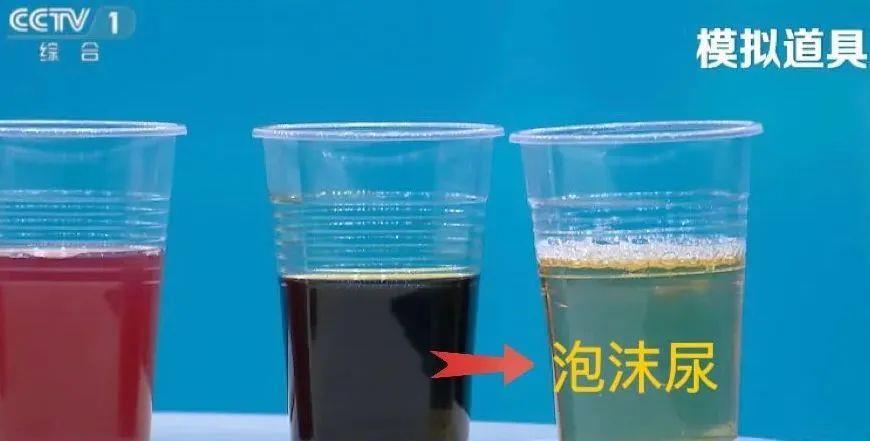 喝水后的5个异常 有1个就需警惕 喝水后的5个异常 有1个就需警惕