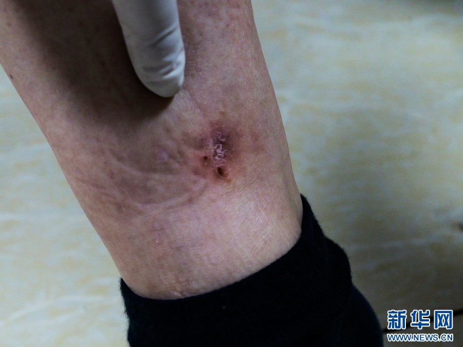 一等功女站长,“露脸”缉毒! 一等功女站长,“露脸”缉毒!