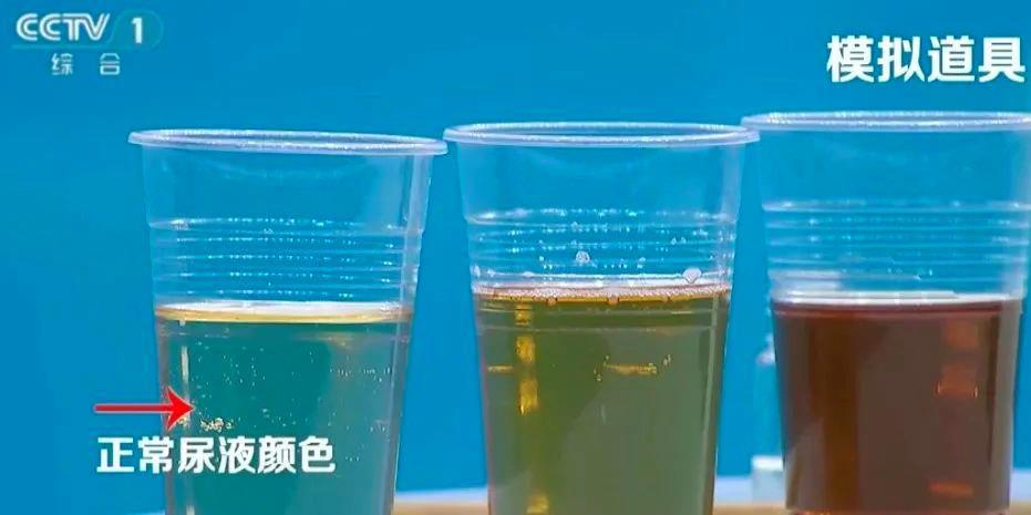 喝水后的5个异常 有1个就需警惕 喝水后的5个异常 有1个就需警惕