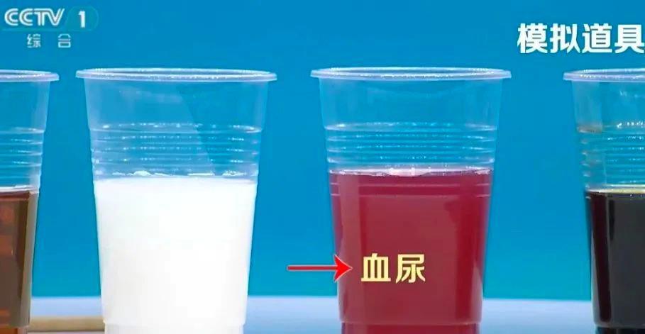 喝水后的5个异常 有1个就需警惕 喝水后的5个异常 有1个就需警惕