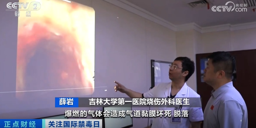 18岁少年全身严重烧伤！只因和朋友“上劲”玩这个→