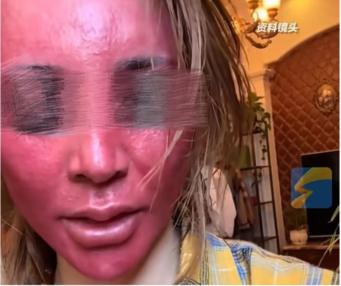 太吓人!女子化妆20年没有卸妆,脸竟然变这样!网友:她怎么能忍住 太吓人!女子化妆20年没有卸妆,脸竟然变这样!网友:她怎么能忍住