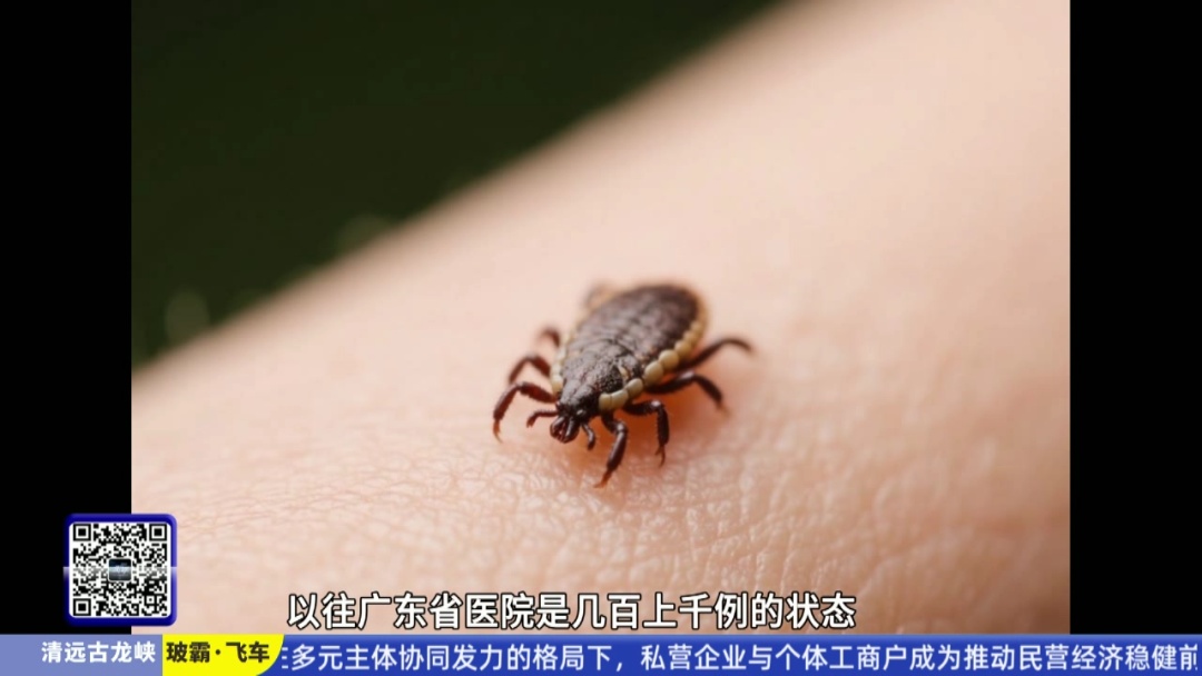 不是感冒，严重可致死！目前正是高发季，已有人中招