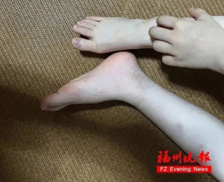 一觉醒来,身上密密麻麻都是……