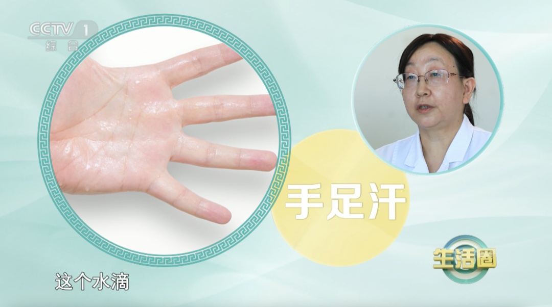 天热出汗多？这4个地方总出汗，小心是身体在报警！转给家人→