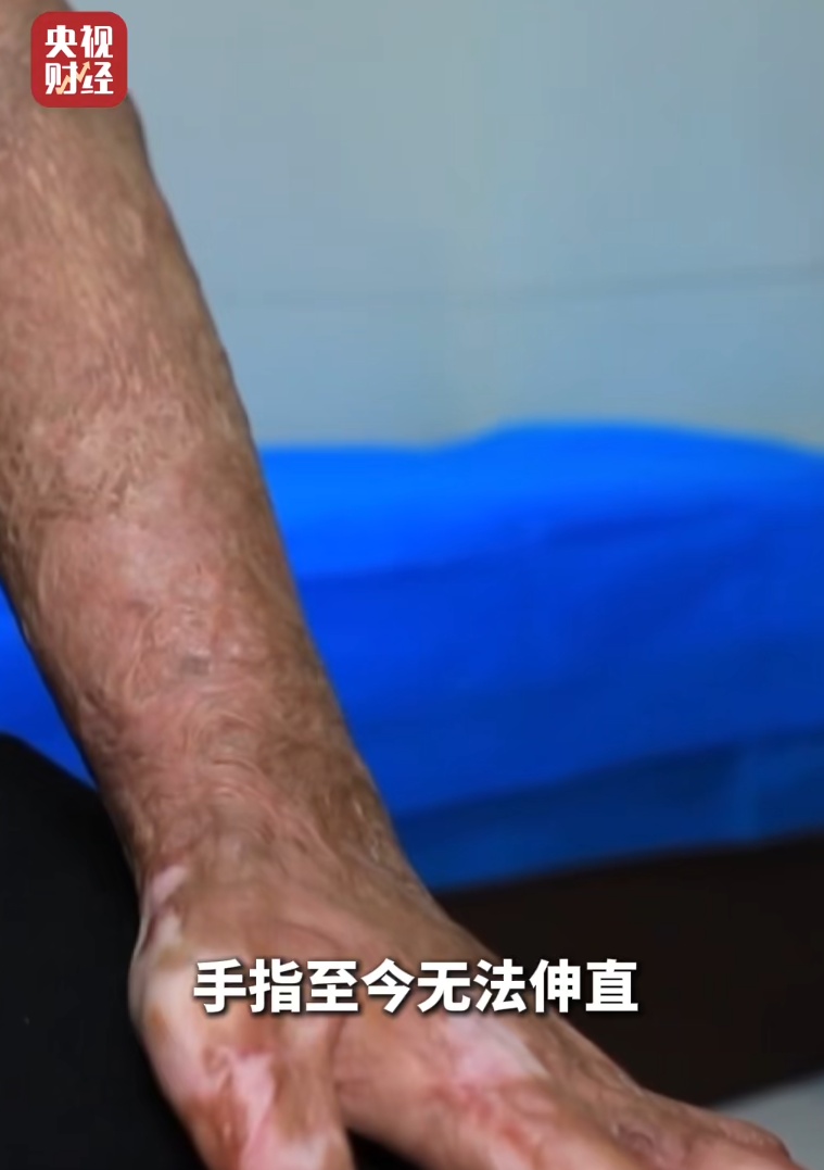 直接在呼吸道里炸了！这种"爽"死亡率很高，有医院一年收治上百例