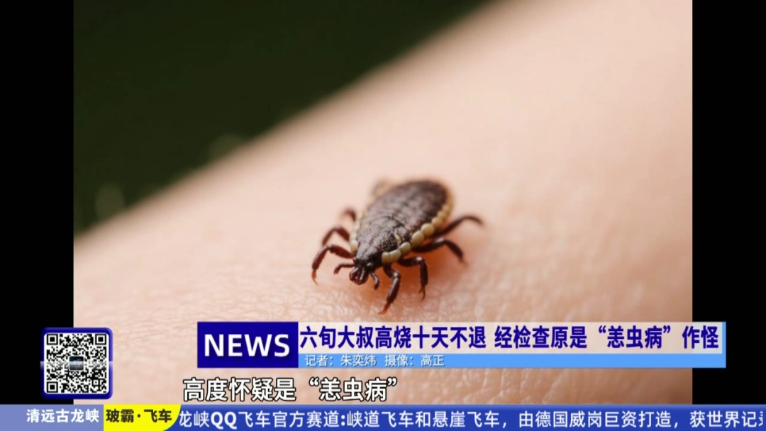 不是感冒，严重可致死！目前正是高发季，已有人中招