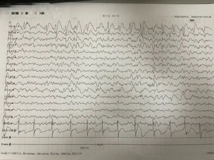 9岁男孩突然确诊!父母难以接受,医生:极易误诊 9岁男孩突然确诊!父母难以接受,医生:极易误诊