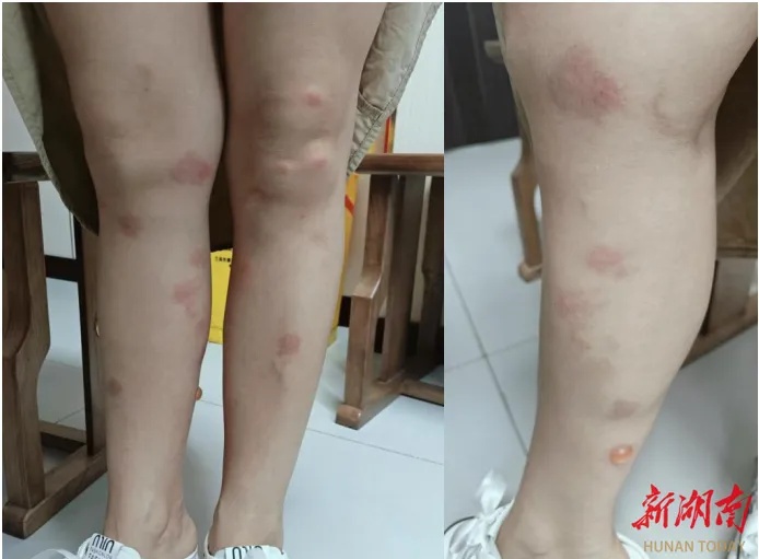 一觉醒来身上密密麻麻全是！天热高发，家家户户都在用！罪魁祸首是它，快自查