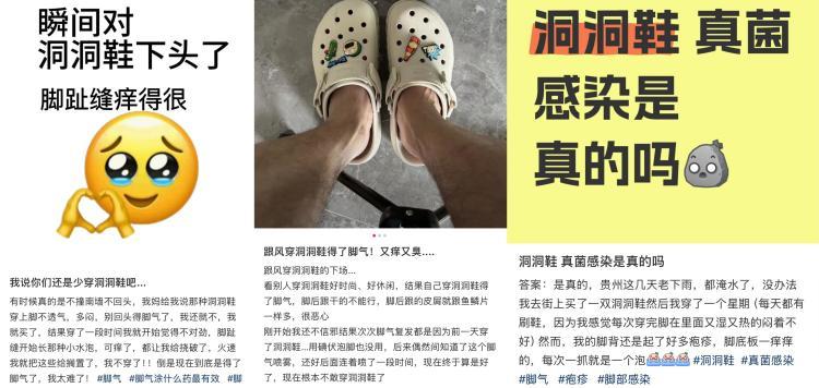 穿着舒服但易引发脚气、易崴脚 “夏季神器”洞洞鞋还能穿吗? 穿着舒服但易引发脚气、易崴脚 “夏季神器”洞洞鞋还能穿吗?