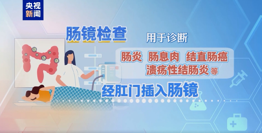 位列癌症发病率前五,七成患者确诊时已为中晚期,这个检查很有必要 位列癌症发病率前五,七成患者确诊时已为中晚期,这个检查很有必要