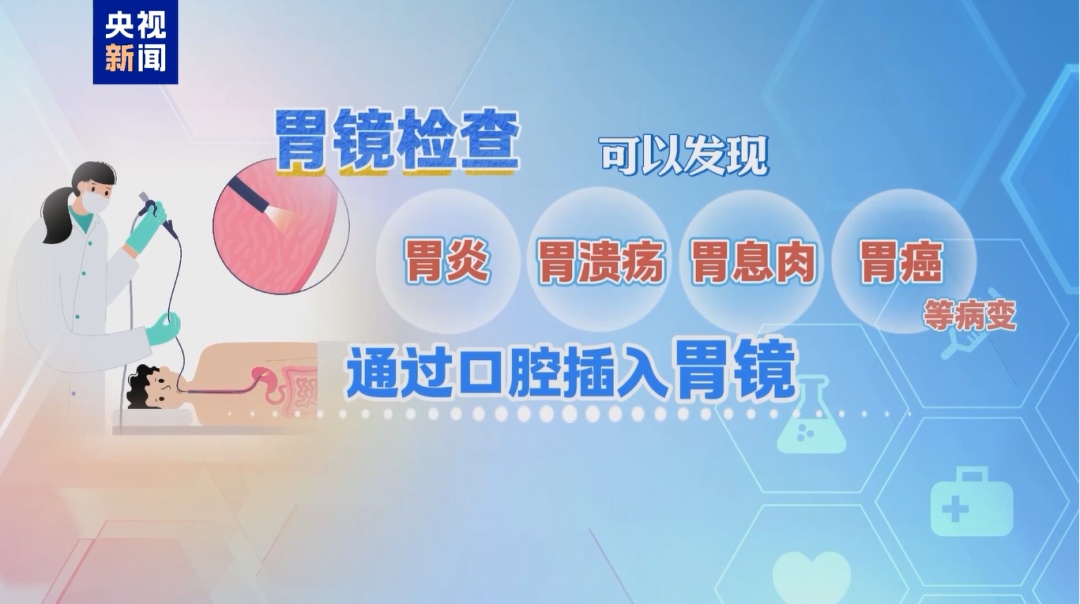 位列癌症发病率前五,七成患者确诊时已为中晚期,这个检查很有必要 位列癌症发病率前五,七成患者确诊时已为中晚期,这个检查很有必要