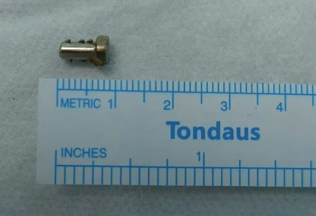 危险!8岁男孩误吞螺丝钉,一个多月才查出 危险!8岁男孩误吞螺丝钉,一个多月才查出