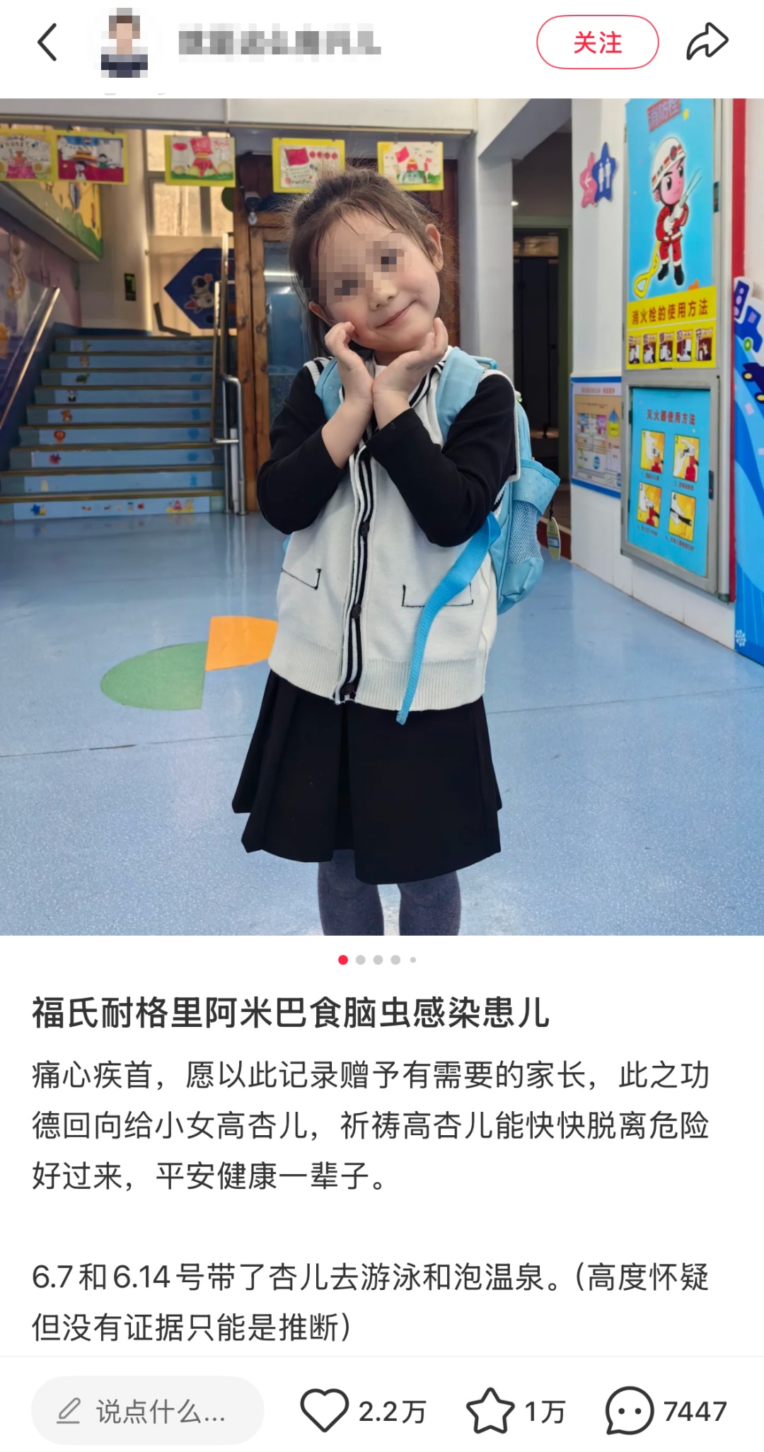 女童泡温泉游泳后感染住进ICU仍在抢救,医生:病死率98%,紧急提醒 女童泡温泉游泳后感染住进ICU仍在抢救,医生:病死率98%,紧急提醒